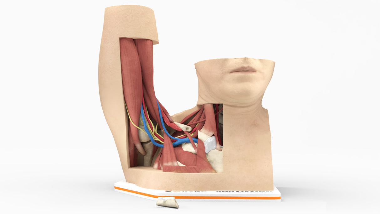 Thoracic Outlet Syndrome (TOS), Arm Up