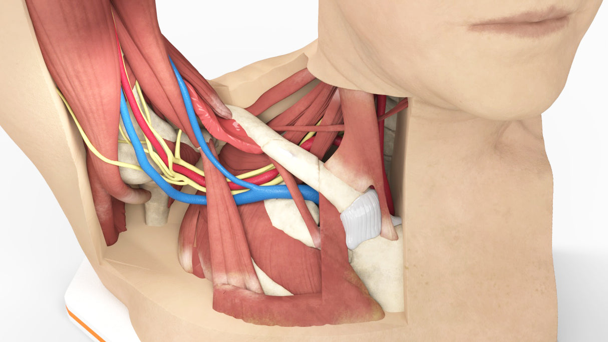 Thoracic Outlet Syndrome (TOS), Arm Up