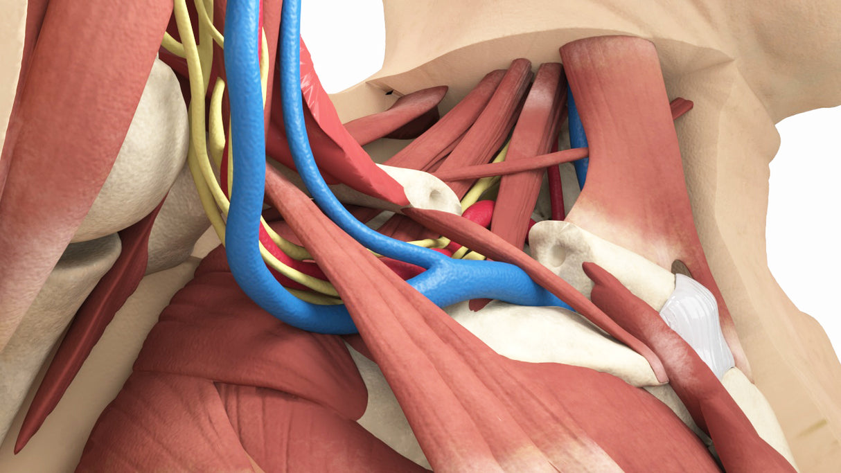 Thoracic Outlet Syndrome (TOS), Arm Up