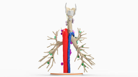 Tracheobronchial Tree With Lymph Nodes