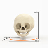 Infant Skull With Unilateral Craniosynostosis of the Lambdoid Suture - Female, 7 Months