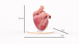 Left Atrium Myxoma, Closed - Female, 73 Years