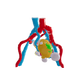 Clear Left Kidney With Neoplasm and Cysts – Male, 78 Years