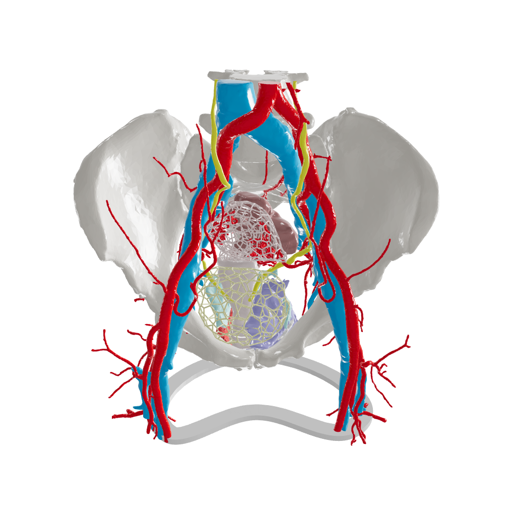 Pelvic Hernia – Female, 48 Years