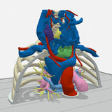 Chest With Mediastinal Paraganglioma – Male, 50 Years