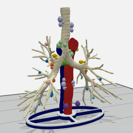 Tracheobronchial Tree With Lymph Nodes